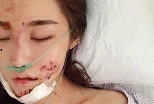 女网红被毁容是谁,揭开背后真相与网络暴力阴影”